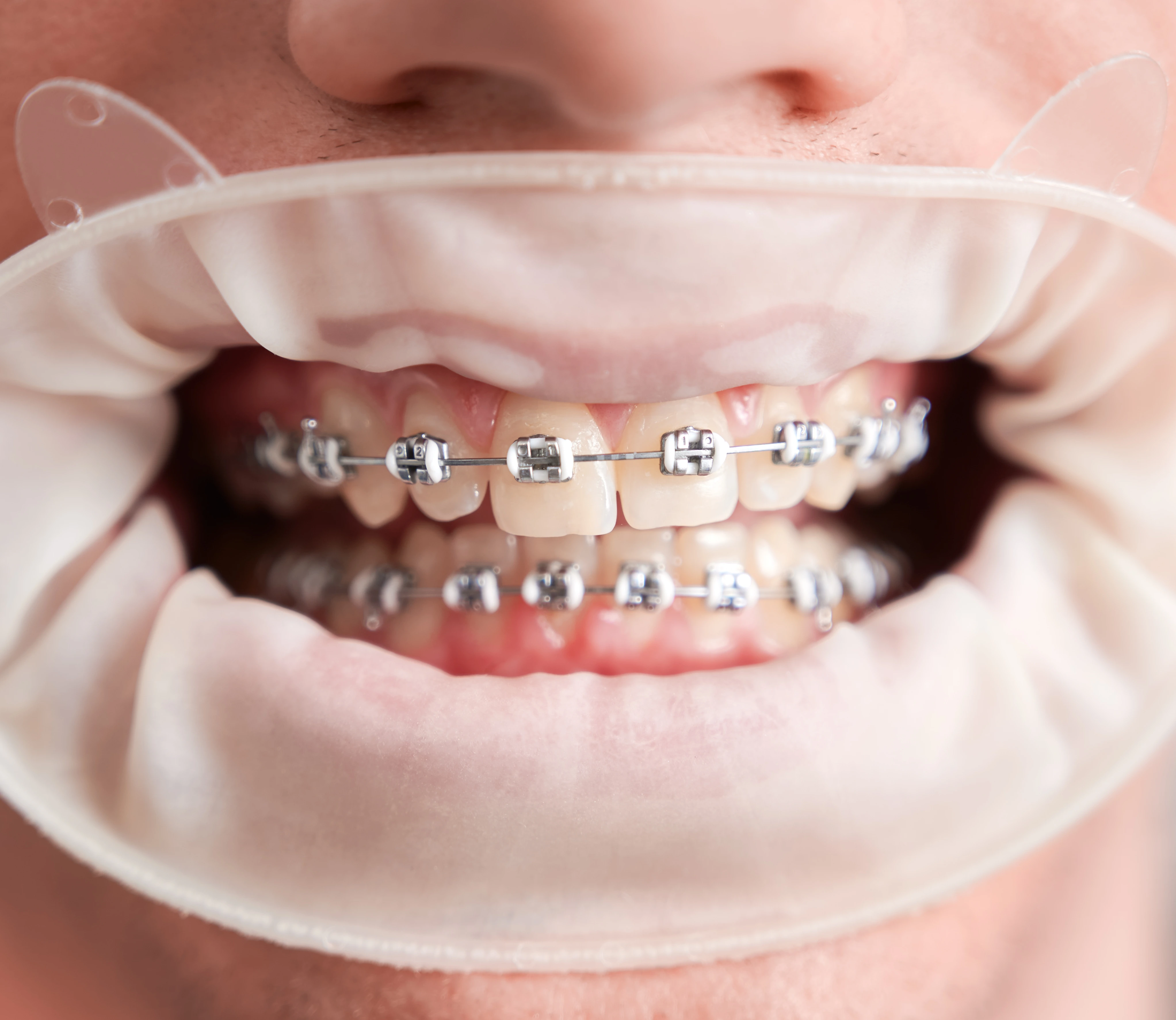 Orthodontics Image